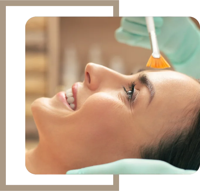 Peeling Químico Helen Dermoestética